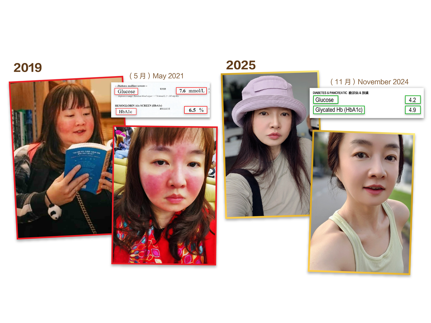 Anniisa Skin Problem